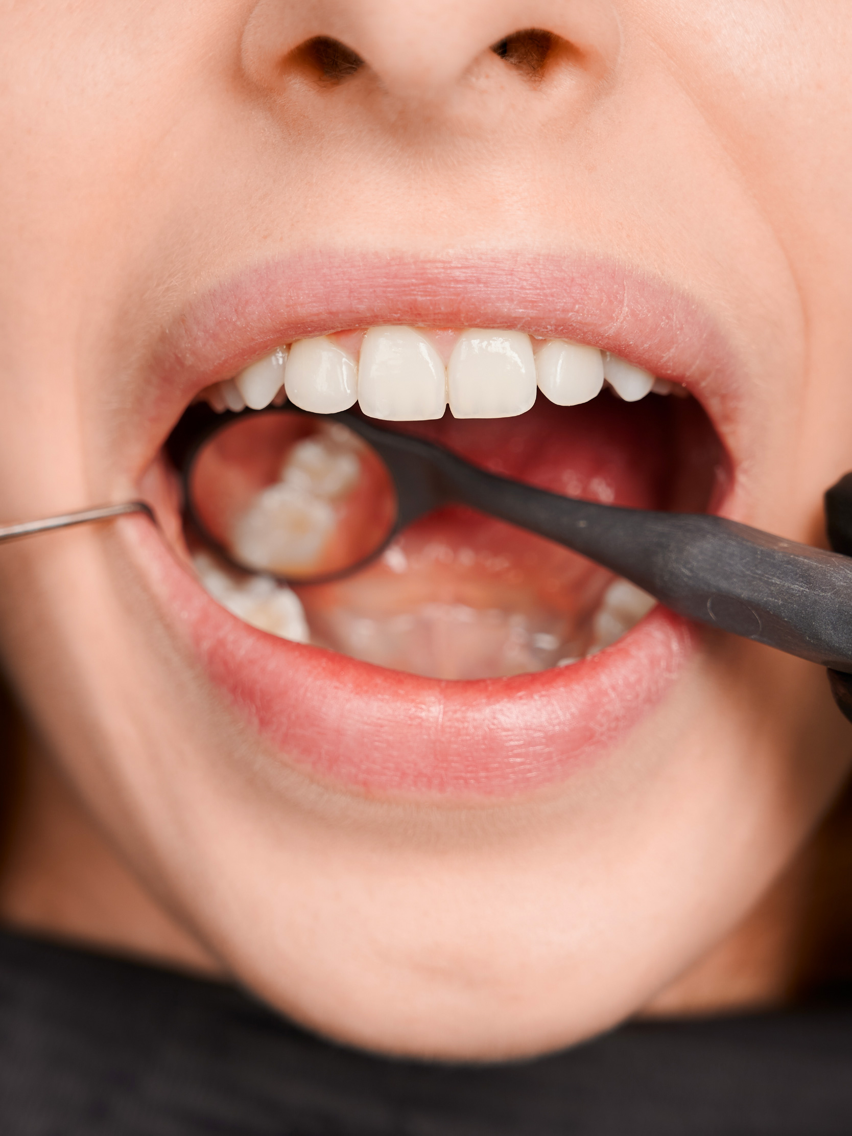 Tratamiento de Periodoncia